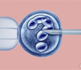 爱德华氏综合征(18三体)有什么症状